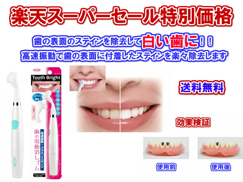 楽天市場 歯の表面に付着したステインを除去 歯の電動消しゴムtooth Bright トゥースブライト 送料無料 即日発送 メール便対応 生活雑貨の伊賀manji堂