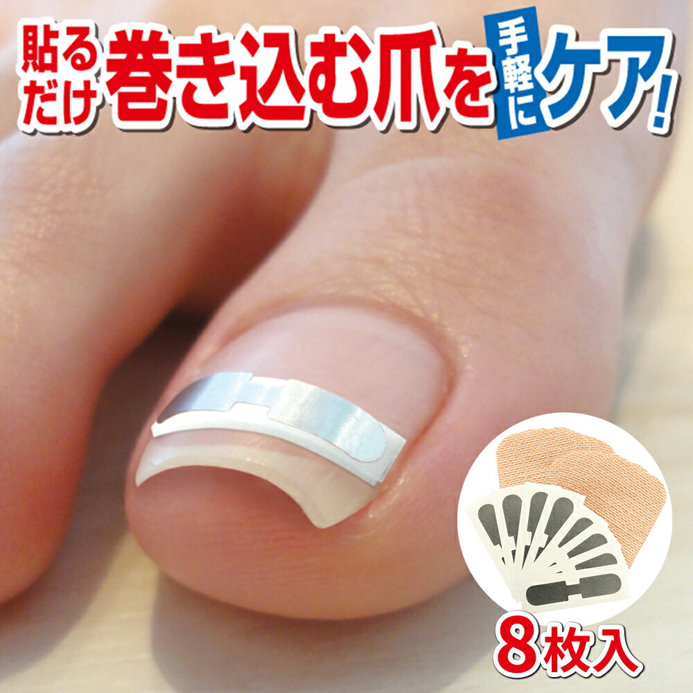 巻き爪　ネイルケア　スターターキット 巻き爪 ネイルケア スターターキット 期限間近！ジェルネイルで