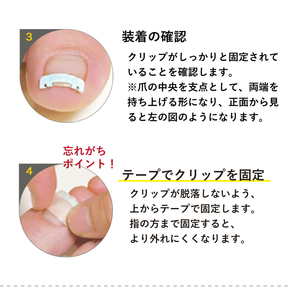 楽天市場 レキットベンキーザー ジャパン ドクターショール巻き爪用クリップｍ 16 5mm マツヨシ 楽天市場店