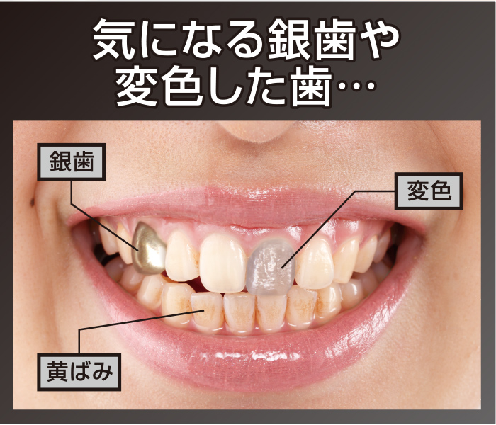 楽天市場 デンタルパール 3ml 2個セット 健康ショップ メガヘルス