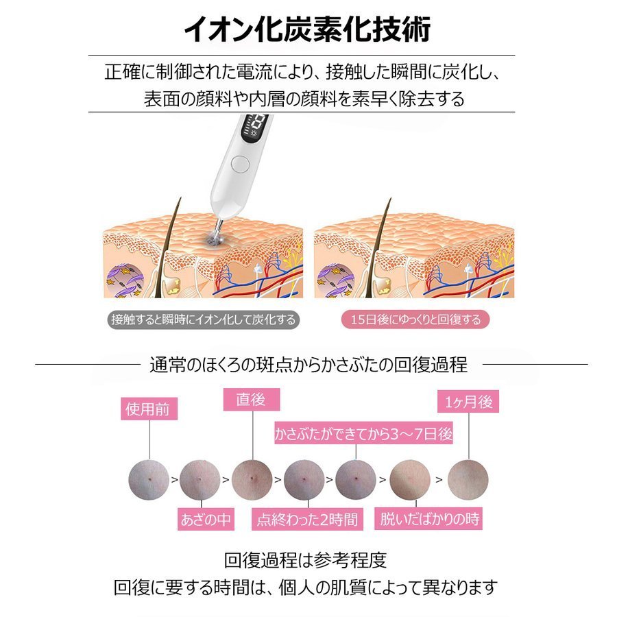 楽天市場 レーザーそばかす除去 21最新 ほくろ除去ペン レーザー除去ペンレーザー ペン スポットペン 家庭用 ほくろ除去液晶ペン ビューティーインアース リムーバーペン プラズマ Atena 楽天市場店