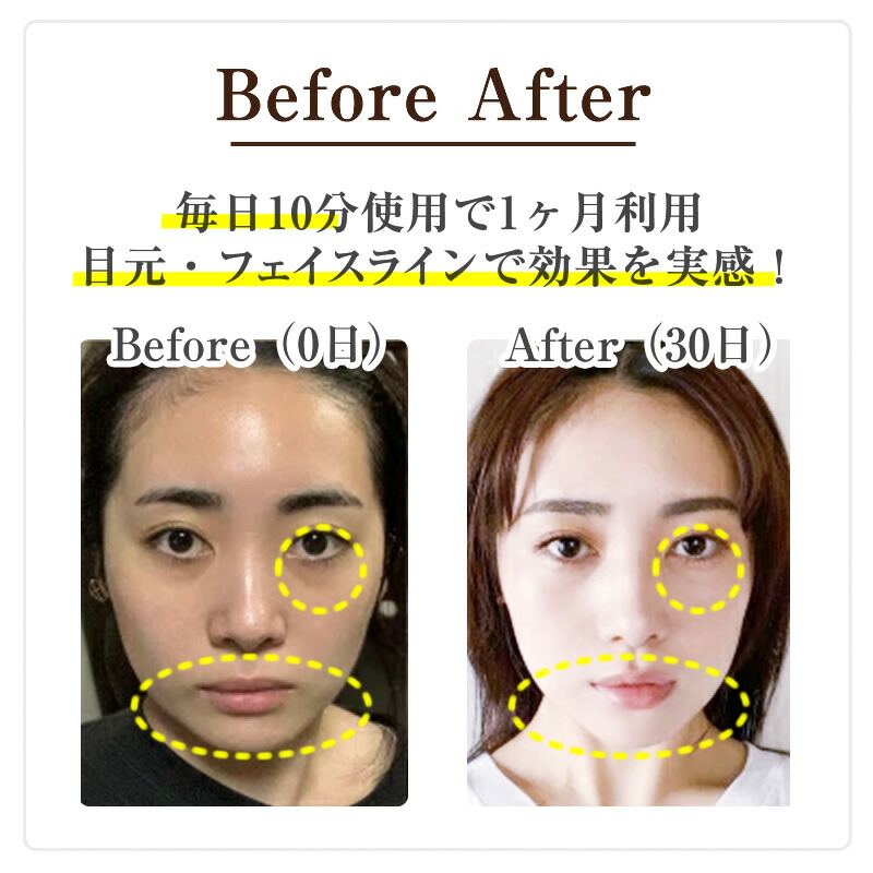 ELFACE公式】 EMS 美顔器 リフトアップ 韓国 ems リフトケア ほうれい