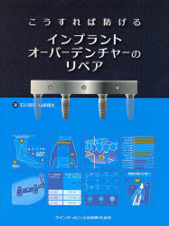 Amazon.co.jp: こうすれば防げるインプラントオーバーデンチャー