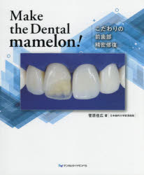 みんなにやさしいマグネットデンチャー: Dr.もDHも患者さんも介護者にも! 出版記念講演】IOD みんなにやさしいマグネットデンチャー