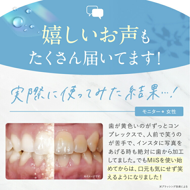 全品20％OFFクーポン】【公式】MiiS ミーズ ホワイティエッセンス