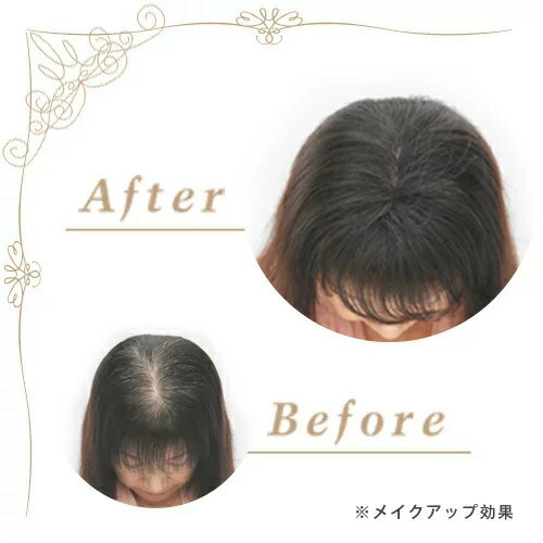楽天市場 ヘアーモーメントp エビス 定期購入 クイック増毛スプレー Hairmoment ヘアモーメント P おすすめ配達間隔30日 40日 ボリュームアップ 美顔器 原液ならモテビューティー