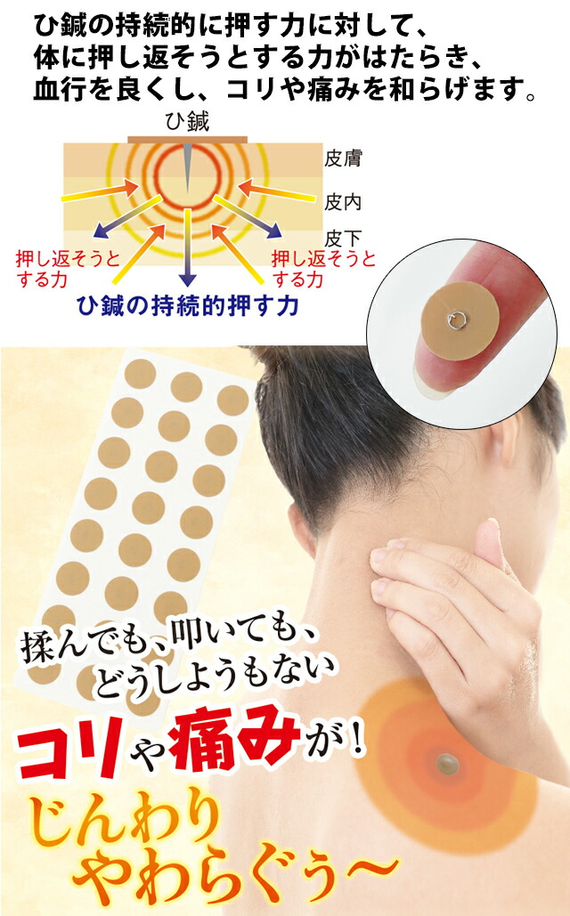 ひ鍼治療法 240指針 皮内針 ひしん 診療遣い道器同じる克ち取る 肩凝り 腰痛 我れで針治療 鍼 針 肩こり 取り止めるグッズ 鍼パッチ ツボ 緊張だけ 鍼治療 首こり ひ針 置鍼 置き鍼 置き針 置針 円皮鍼 ハリ治療 パッチ鍼 パッチ針 判こ針 シール鍼 鍼治療用器械 貨物輸送