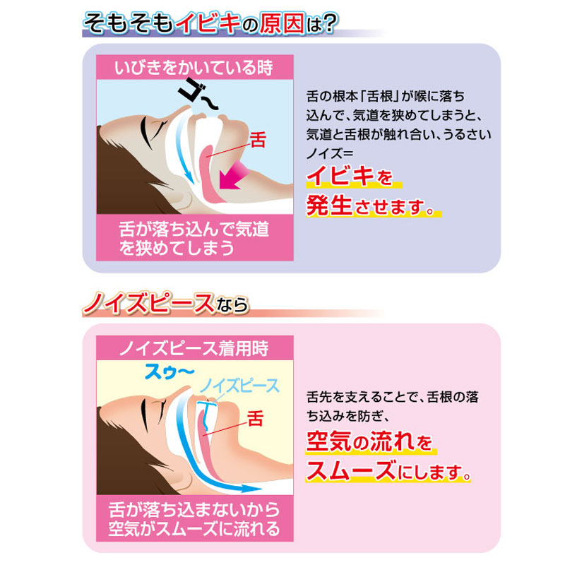 いびき マウスピース いびき防止 舌 鼻呼吸 口 洗える いびき防止