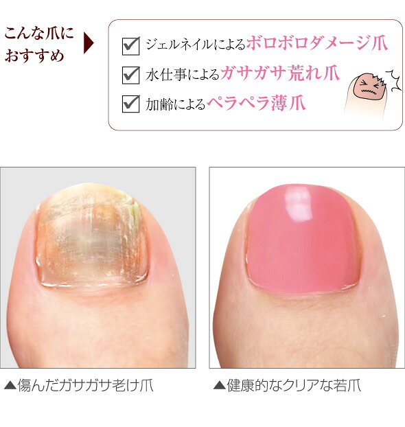楽天市場 メール便 送料無料 美容液ネイル ネイル美容液 ペディキュア ネイル 水溶性 美容液 美容成分 割れ爪 二枚爪 乾燥爪 甘皮 ささくれ 補修 マニキュア ジェルネイル ネイルケアグッズ ギフト プレゼント 足爪の休日 ギフト プレゼント セール 1 専門家