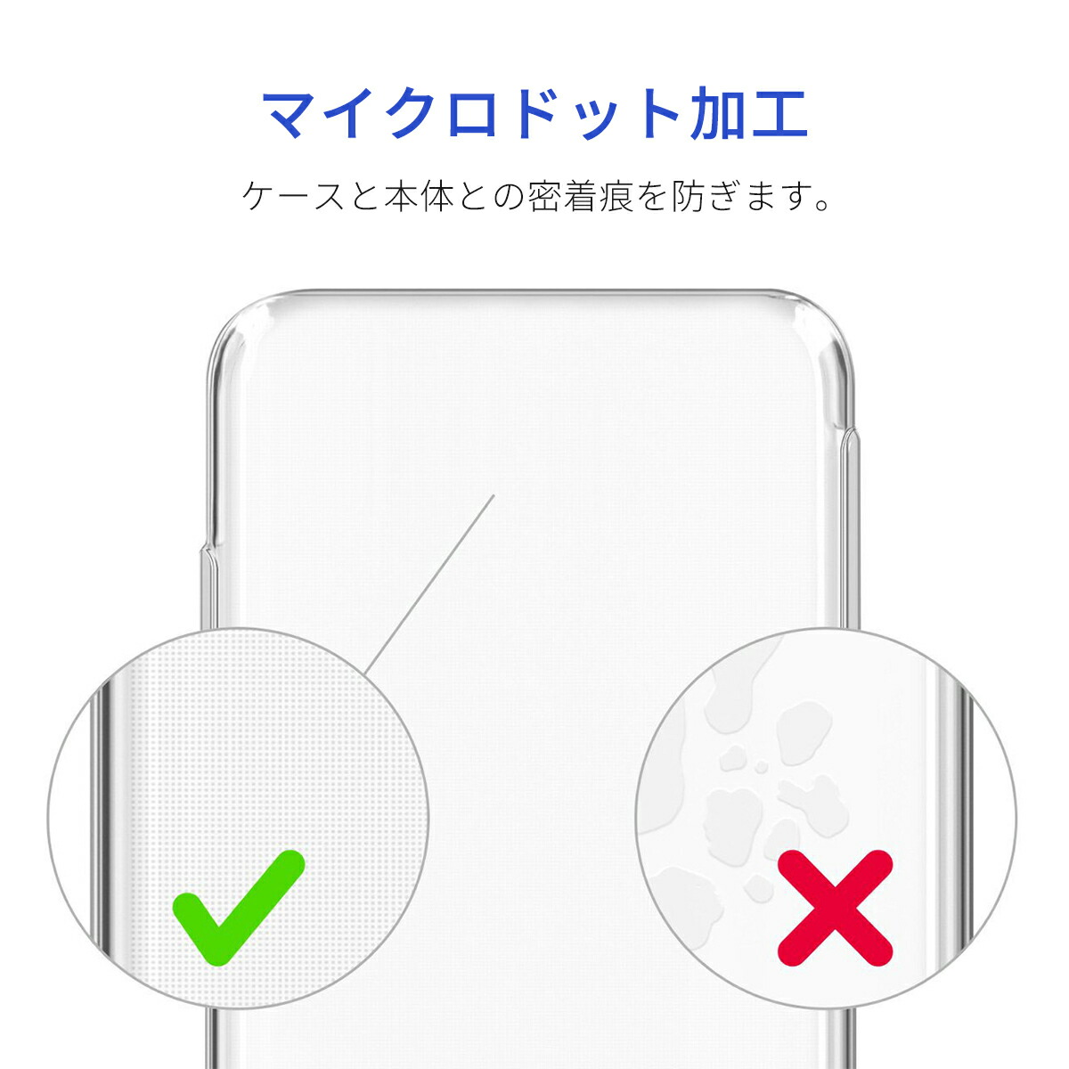 楽天市場 Rakuten Big 楽天ビッグ ケース スマホ クリアケース ストラップホール 耐衝撃 保護 楽天モバイル Simフリー 画面 保証 高透明 クリア 透明ケース 送料無料 ポイント2倍 My Way Smart 楽天市場店