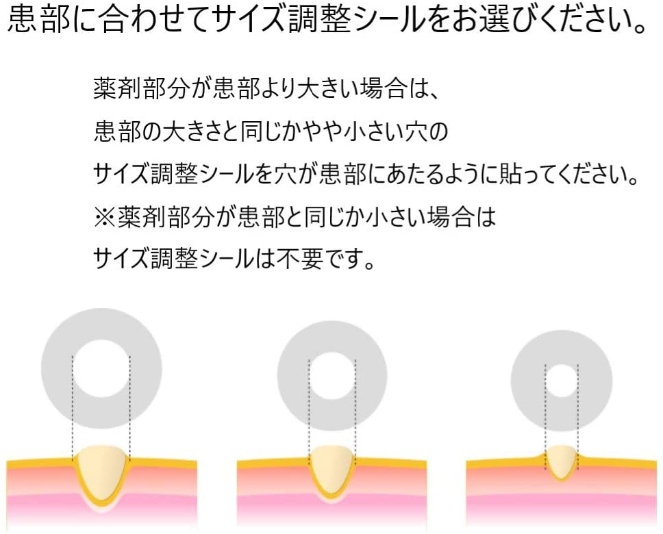 楽天市場 第2類医薬品 定形外郵便 ニチバン スピール膏ワンタッチex ゆび Lサイズ 12枚入 指 足裏の魚の目 タコ いぼに N丁目薬品