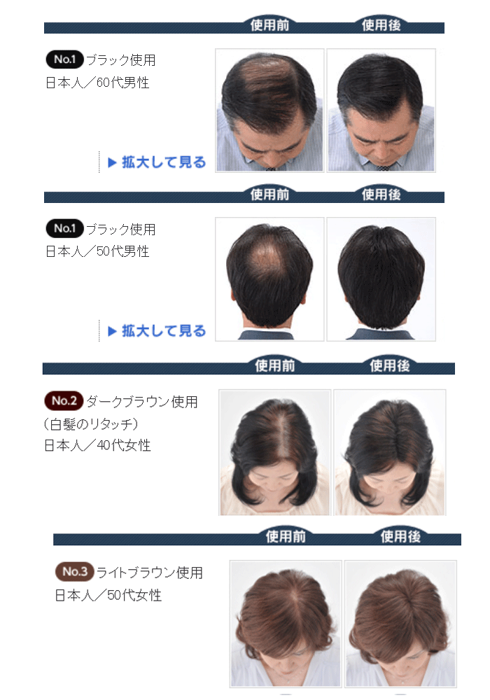 市場 スーパーミリオンヘアー ミディアムブラウン スーパーミリオンヘアー10ｇ+スーパーミリオンヘアスプレー35ｇ No.23 レディースセット