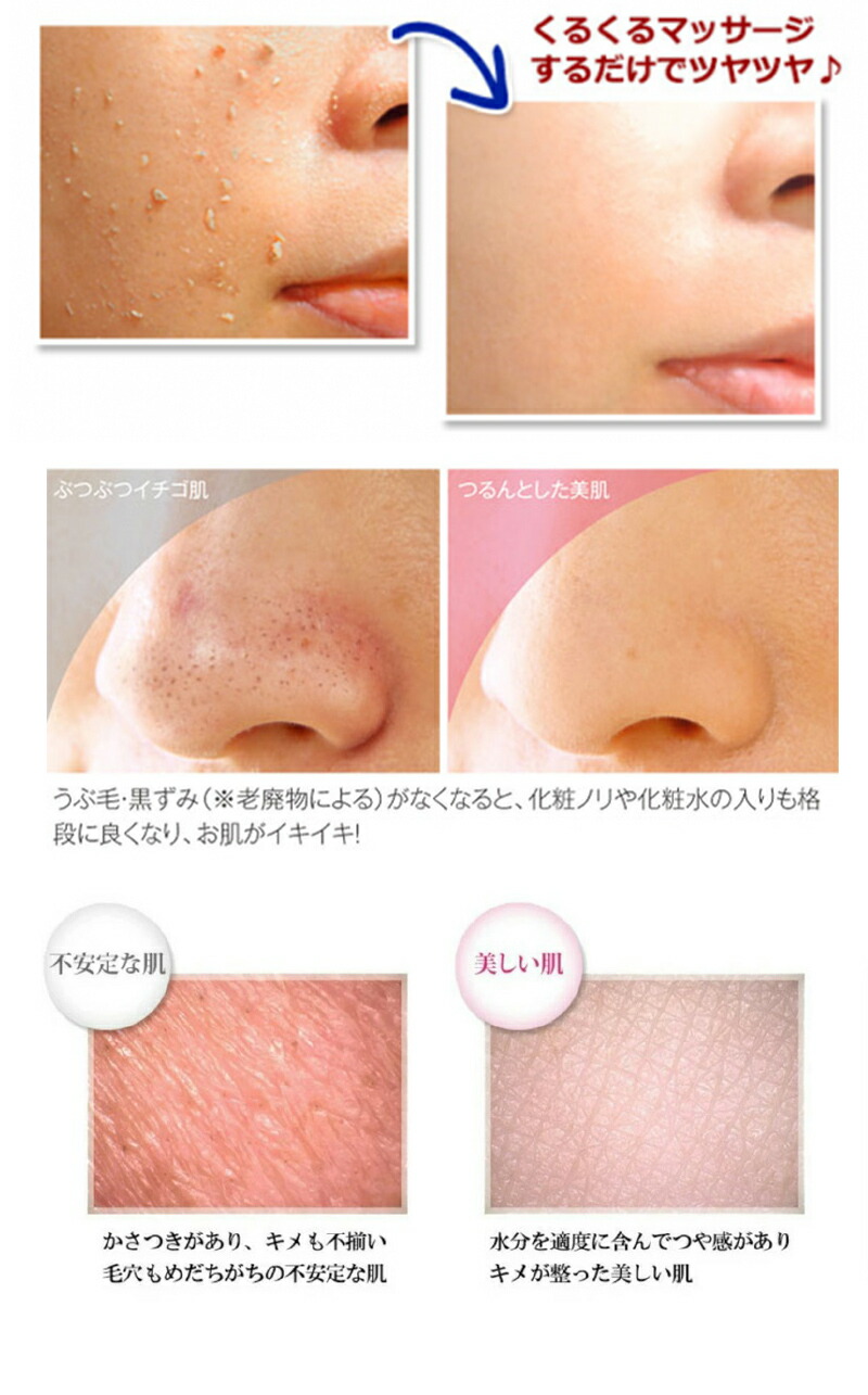 美容家の中で話題♡最新のピーリング！プラピール⭐️美容サロンでNO.1のケアです✨ ZX-CLINIC【公式】｜大阪梅田・北新地からすぐの安くて承認機