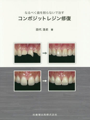 概説ピエール・フォシャール歯科外科医 近代歯科医学の端緒