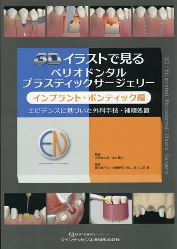 書籍のゆうメール同梱は2冊まで 3dイラストで見るペリオドンタルプラスティックサージェリー インプラント ポンティック編 本 雑誌 歯学 中田光太郎 監著 木林博之 監著 小田師巳 著 岡田素平太 著 小田師巳 著 園山亘 著 山羽徹 著 ネオウィング 店 Font Size 2