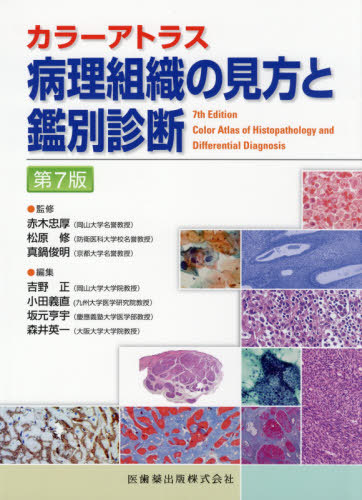 病理敷設のスタンスと鑑別読み合す 序数7バージョン 著作 学報 色艶アトラス 赤木忠順厚 宰領 松原修 監修 真鍋俊明 監修 吉野正しさ 集大成 稲田義直 編集 坂元亨宇 編集 森井英一 編集 Marchesoni Com Br