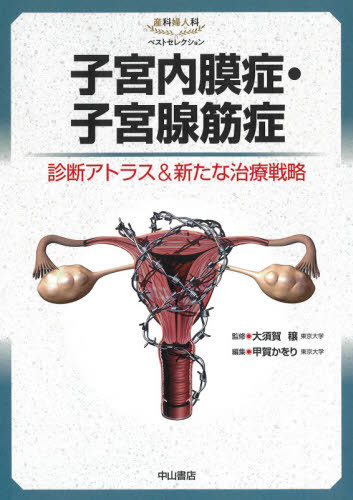 母胎内膜症 子宮腺筋症 チェックアトラス 新なセラピー企図 付け根 マガジン 産分野小母上科無上選定 大須賀穣 総理 甲賀かをり 編纂 電子メイル便宜受け入れる不可 Drcade Com