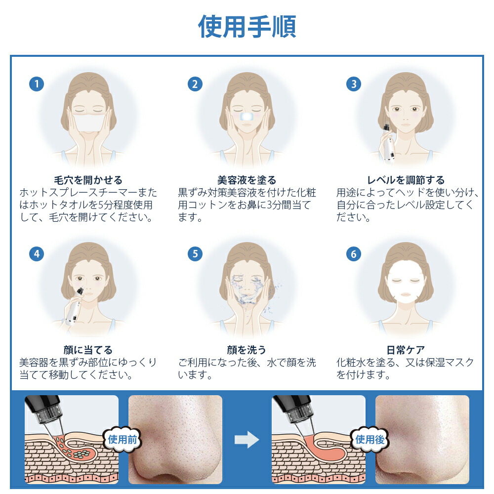 楽天市場 全店通用10 Offクーポン付き 毛穴吸引器 毛穴ケア 毛穴クリーナー 美顔器 毛穴クリーン 毛穴吸引 黒ずみ吸出し 毛穴汚れ 皮膚クレンジング 角栓取り コードレス 黒ずみ ケア フェイスケア スキンケア ニキビ 毛穴 角栓 鼻 あご いちご鼻 男性 女性