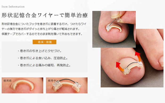 楽天市場 500円クーポン配布中 巻き爪ワイヤーガード 巻爪 まきづめ 巻きつめ まきつめ 矯正 器具 ロボ ブロック ワイヤー 痛い 手術 爪切り ニッパー 皮膚科 治療 痛い ズキズキ 足の爪 食い込み 送料無料 日本ネット通販 健康器具 美顔器
