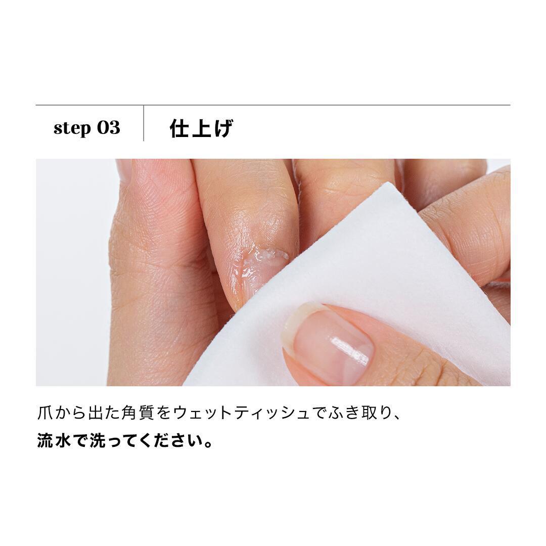 楽天市場 公式 Pro Loose Skin Remover Pc Lr 001 Ohora Gelnails Nail オホーラ ネイル ジェルネイル ネイルシール セルフネイル ネイルステッカー おうちネイル ネイルデザイン 簡単ネイル ネイルステッカー ネイルオイル ネイルパーツ ネイルチップ カラージェル