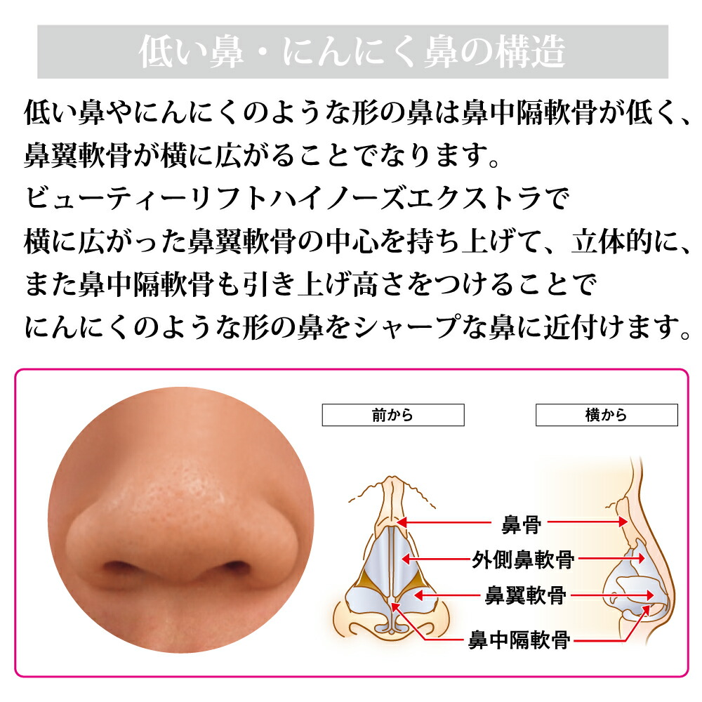 楽天市場 美鼻矯正器具 鼻 矯正 鼻 高く 鼻プチ 美鼻 リフトアップ 鼻筋 団子鼻 矯正 わし鼻 にんにく鼻 Eライン 小鼻 プチ整形 美顔器 Omni オムニ ビューティーリフトハイノーズex エクストラ Omni Online Store