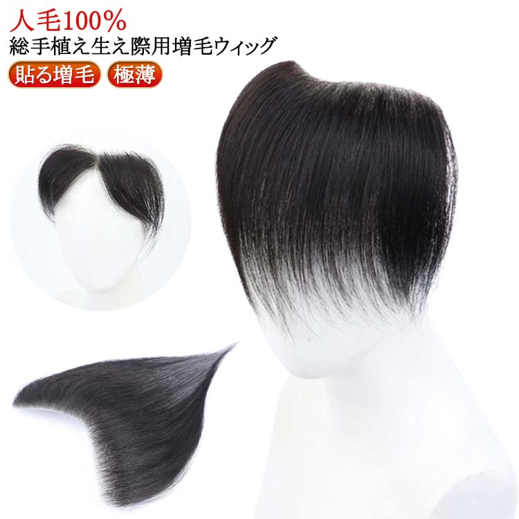 【送料無料】生え際 増毛 メンズ 男性用 増毛シート 生え際 シール 黒 貼る 生え際 M型 脱毛症 ポイントウィッグ 部分ウィッグ かつら シール式 脱毛症 貼るウィッグ 対策 ハゲ隠し つけ毛 エクステ ヘアピース 手植え 人毛