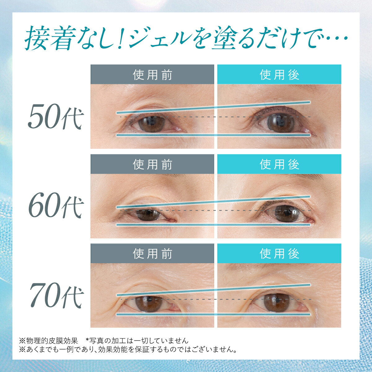 まぶた 引き上げ ジェル 整形膜「リッドキララ」北の快適工房 まぶた