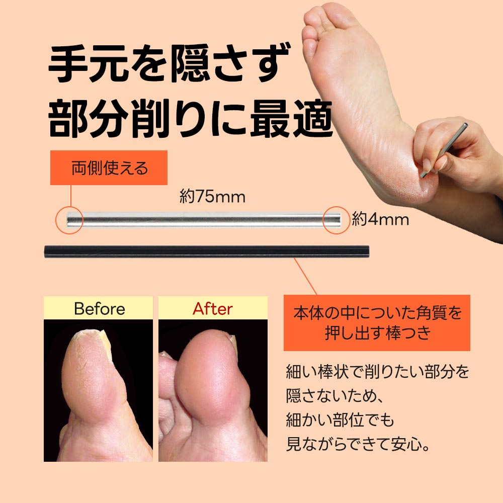 楽天市場 かかと 削り 角質除去ガンコな魚の目や角質に スクラッチ フットケア イボ削り 角質 角質取り 足 たこ 除去 角質削り かかと 足裏 手 魚の目 削り カッター うおのめ削り うおの目 ウオノメ うおのめ タコ たこ取り タコ取り メール便a お手軽美人