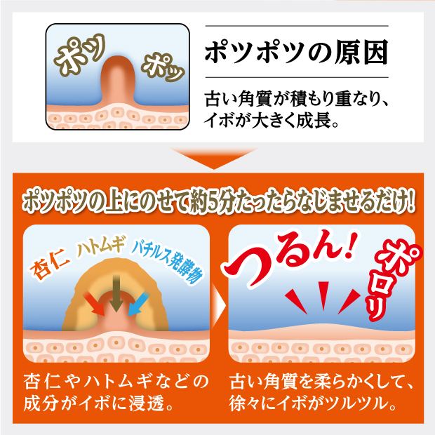 0の附帯日日限度 全品まっ只中枢2倍加 引き換え証も 取って置く嘉賞中 メーカ公式 イボ 取る 角質 ポツポツ 平頚 イボ援助 角質ケア イボ取り オイル イポロンc 皮膚軟化剤 角質粒子 いぼ取りクリーム 首 建て前 老輩 杏仁オイル ハトムギオイル イポロン Glim グリム 2個