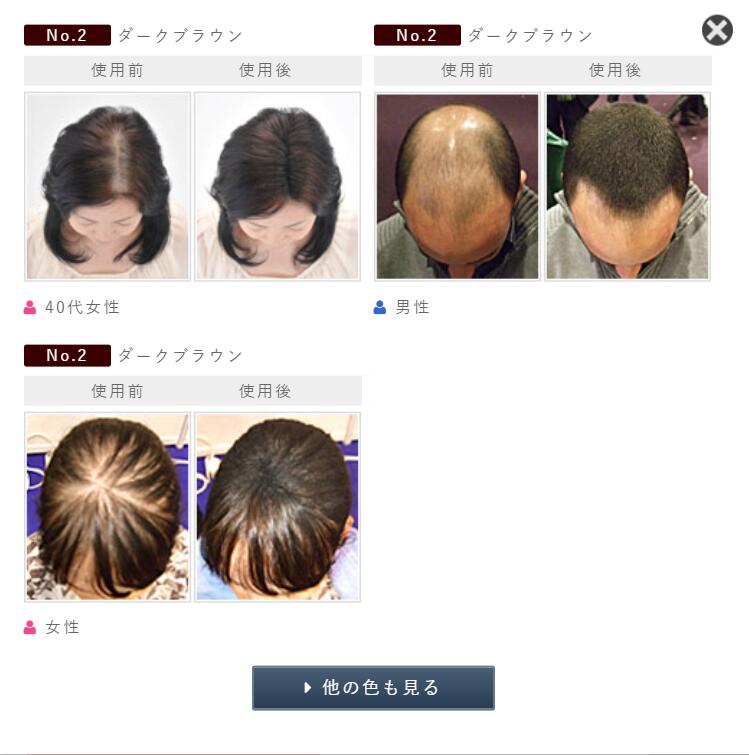 人気の スーパーミリオンヘアー ブラック ダークブラウン 20g お得3個セット シャンプー ヘアケア ヘアスタイリング ヘアカラー  カラーリング白髪染め SMH レビュー特典付 fucoa.cl