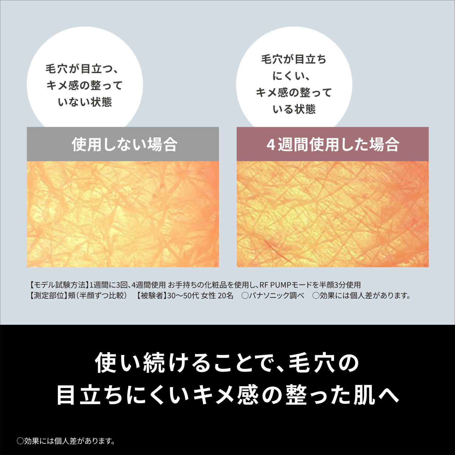 公式店】パナソニック リフトケア*美顔器 美顔器 バイタリフトRF