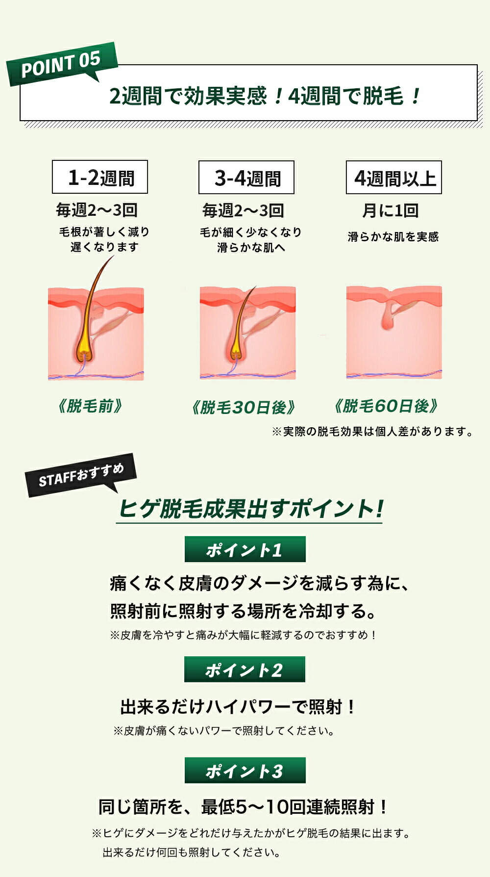 75%OFF!】 プロ仕様モデル メンズ ヒゲ脱毛専用器 脱毛器 冷却ダイヤモンドサファイヤ Ｕlike ユーライク 男性用光美容器 IPL脱毛  脱毛機 脱毛 家庭用 光脱毛器 ipl フラッシュ 髭 ワキ 腕 胸 足 男性用脱毛 ムダ毛処理 fucoa.cl