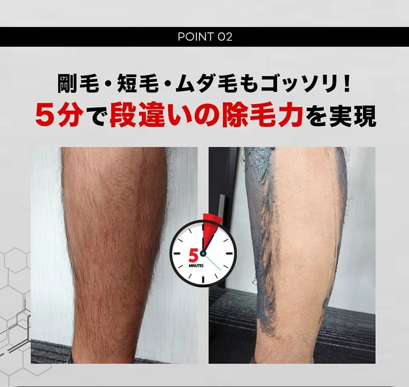 Stay Free ステイフリー Rocky ブラックリムーバー 除毛クリーム 0g 5本セット 医薬部外品 Stay Free 脱毛 10 送料無料 ロッキー メンズ Vio 日本製 低刺激 スキンケア 除毛 脱毛 抑毛 ムダ毛 最速5分 脱毛クリーム デリケートゾーン アンダーヘア Umu Ac Ug