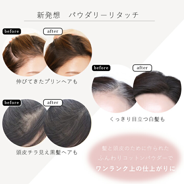 4個セット ボリュームアップ Lalachuu ふた リタッチ ヘアファンデーション バンド 生え際 韓国 小顔 出産祝い コスメ ララチュー 薄毛 パウダー ファンデ 女性 男性 白髪カバー 薄毛隠し テカリ 白髪隠し ウエットシートのふたbitatto公式白髪隠し 髪のボリュームアップ