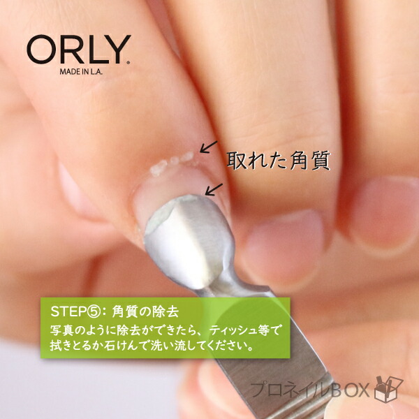 楽天市場 オーリー Orly ジェルｆｘ キューティクルプッシャー リムーバー おたまプッシャー 甘皮押し上げ ルーススキン除去 ジェルオフ 品番 プロネイルｂｏｘ 楽天市場店