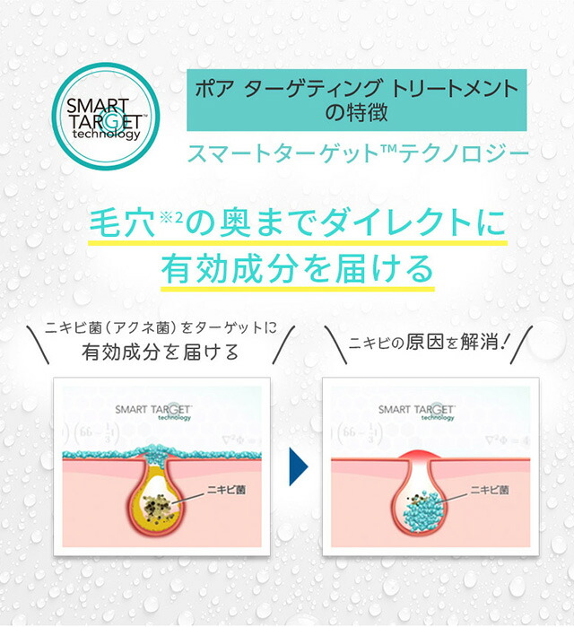 ポアターゲティングトリートメントの特徴