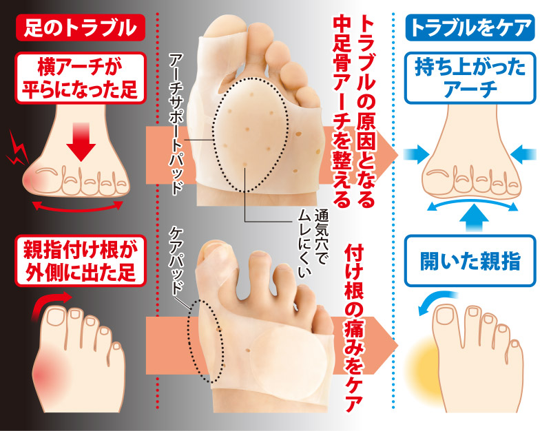 楽天市場 外反母趾 サポーター 勝野式 ワンタッチ足裏サポーター Ra Kurasi メイダイ直営店