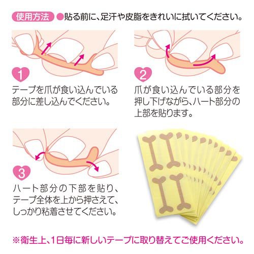 アイメディア巻き爪ケアテープ