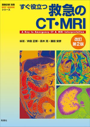 ΩĵߵޤCTMRI2