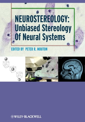 気質アップ Neurostereology Unbiased Stereology Of Neural Systems Wiley Blackwell 電子書籍版 最安値に挑戦 Rainboinitiative Sl