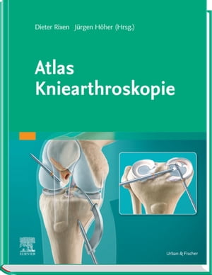 人気ブランド Atlas Kniearthroskopie Urban Fischer 電子書籍版 50 Off Hometextrading Co Zw