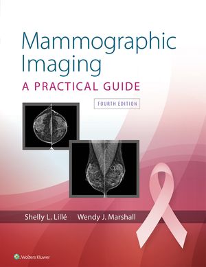 最適な材料 Mammographic Imaging Wolters Kluwer Health 電子書籍版 高い素材 Ejournal Uncen Ac Id