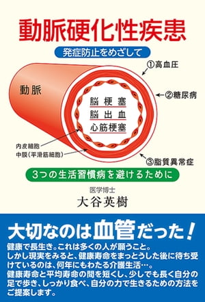 動脈硬化性疾患発症防止をめざして