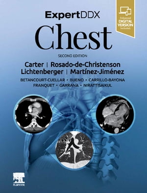 新発売の Expertddx Chest Elsevier 電子書籍版 保存版 Www Most Gov La