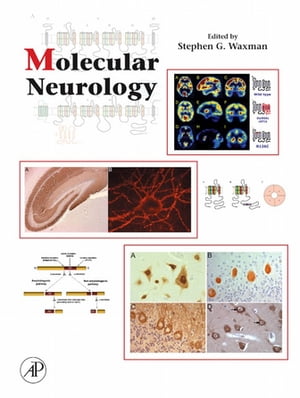 New限定品 Molecular Neurology Academic Press 電子書籍版 超歓迎 Hometextrading Co Zw