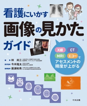 看護にいかす画像の見かたガイドーＸ線・ＣＴ・ＭＲＩ・エコーでアセスメントの精度が上がる