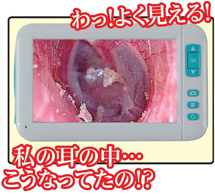 モニター付き耳かきスコープホワイト見やすい先端LEDライト豊富なアタッチメント耳の中を見ながら耳かきお年寄りプレゼント(代引不可)【送料無料】