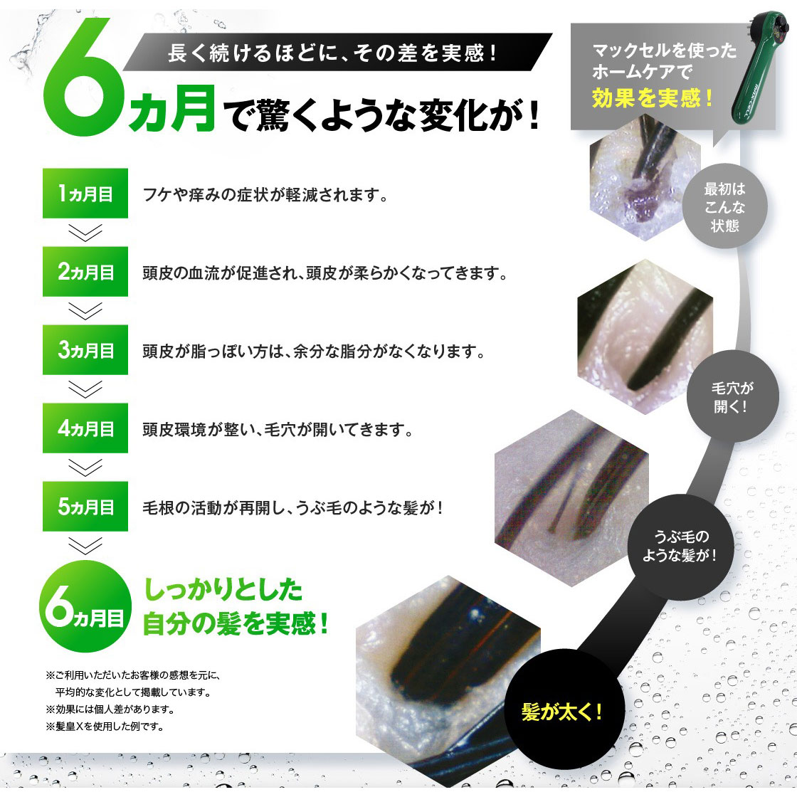 楽天市場 リーブ21 マックセル 男女兼用 頭皮マッサージ Ems 高周波 低周波 マッサージ器 電動 頭皮ケア 自宅 地肌 スカルプケア ヘアケア グッズ 器具 ホームケア 頭皮ブラシ 頭皮ケアブラシ 男性 女性 メンズ レディース 高低周波機器 美容器 マッサージャー リーブ