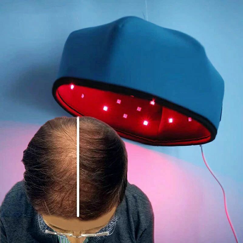 楽天市場】【1年保証】育毛キャップ 育毛システム120個 育毛 赤色 led