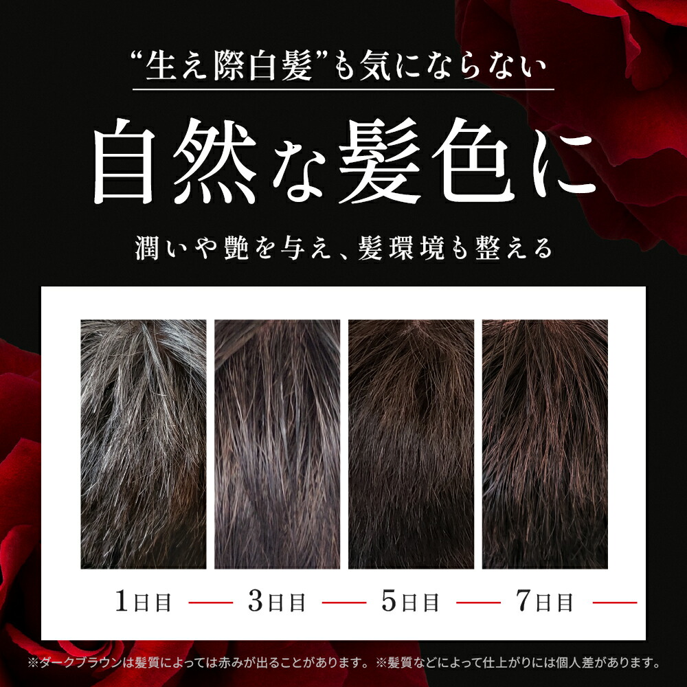 ブラック　新品　2個セット　　　400g バランローズ　VILANROS 白髪 Amazon | 白髪染め シャンプー トリートメント バランローズ